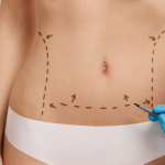 Dr. Roberto Ramírez Macías: Innovación y Excelencia en Cirugía Estética en Aguascalientes